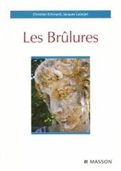 brulures